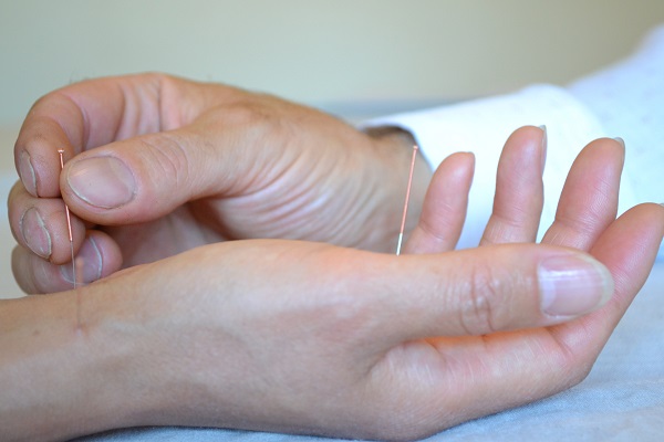 Acupuncture Sandycove | Acupuncture Ashbourne