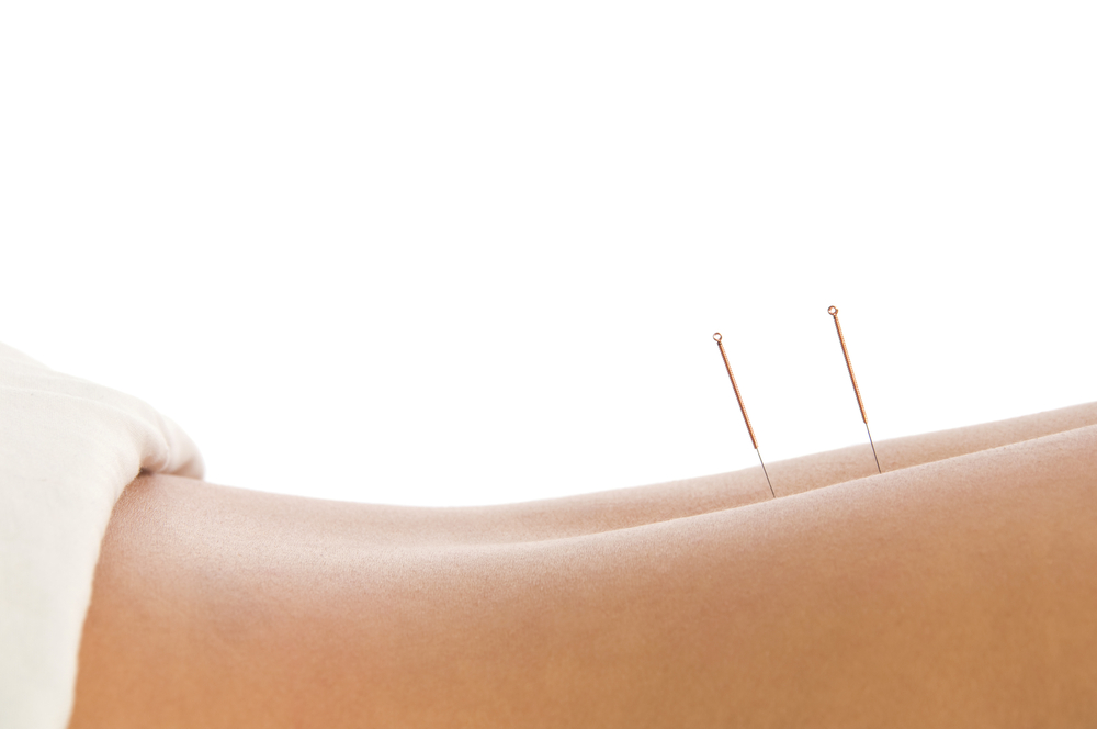Acupuncture Ashbourne Acupuncture Sandycove Acupuncture Dun Laoghaire